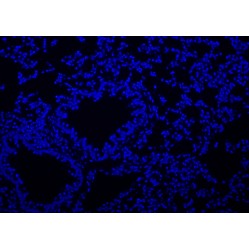 copy of Prestained Protein Marker Ⅹ (10-180 kDa)
