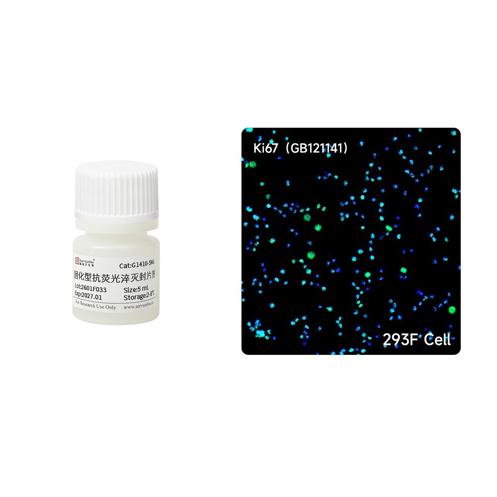 Hardset Anti-fade Mounting Medium