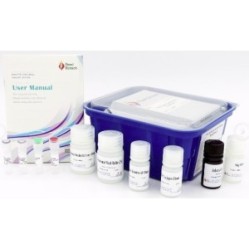 Human IL-21(Interleukin 21) ELISA Kit