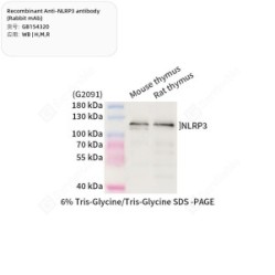 Recombinant Anti-NLRP3 antibody (Rabbit mAb)