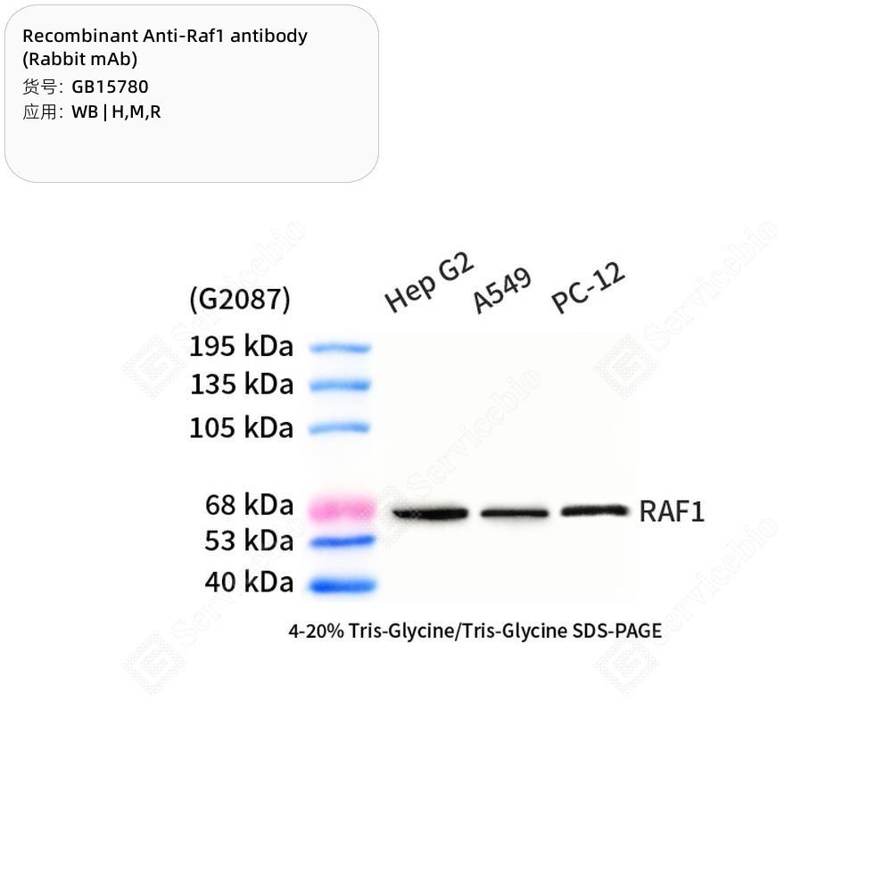 Recombinant Anti-Raf1 antibody (Rabbit mAb)