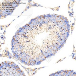 Recombinant Anti-ALIX antibody (Mouse mAb)
