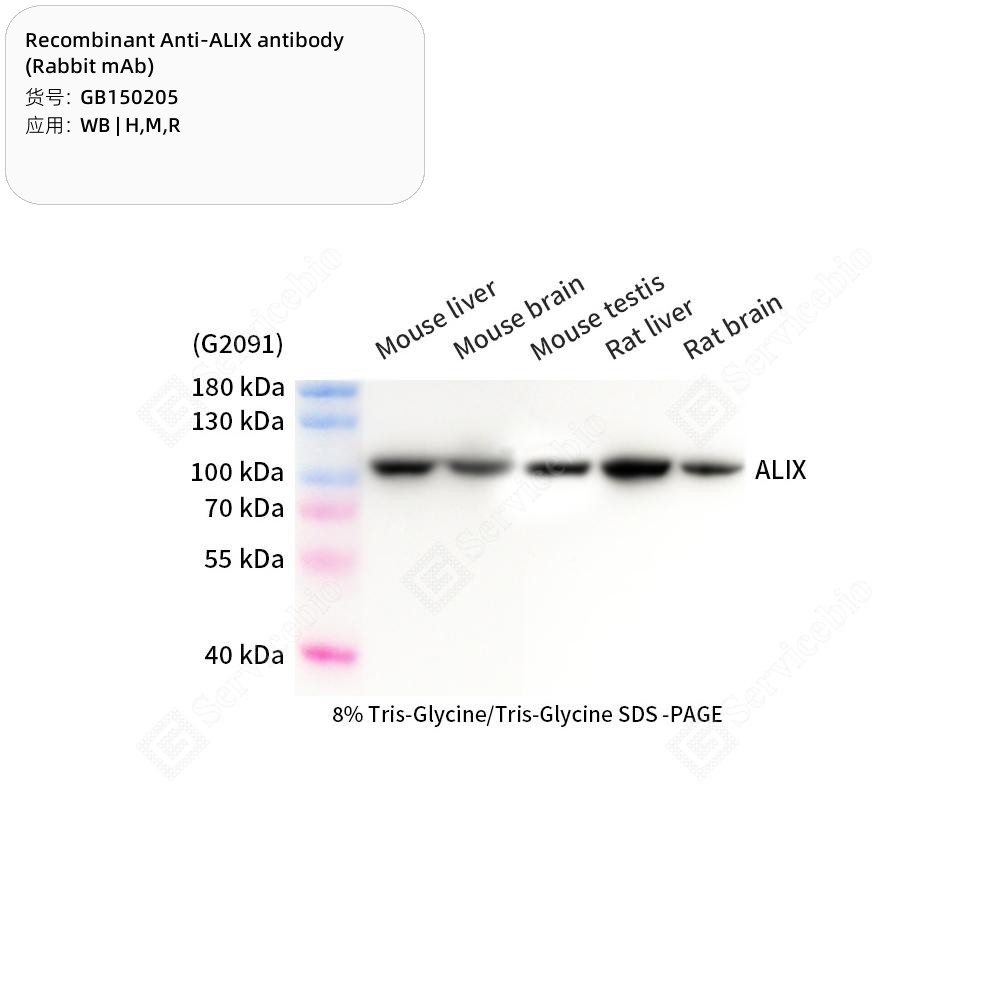 Recombinant Anti-ALIX antibody (Rabbit mAb)