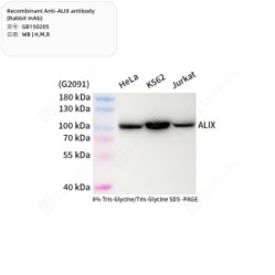 Recombinant Anti-ALIX antibody (Rabbit mAb)
