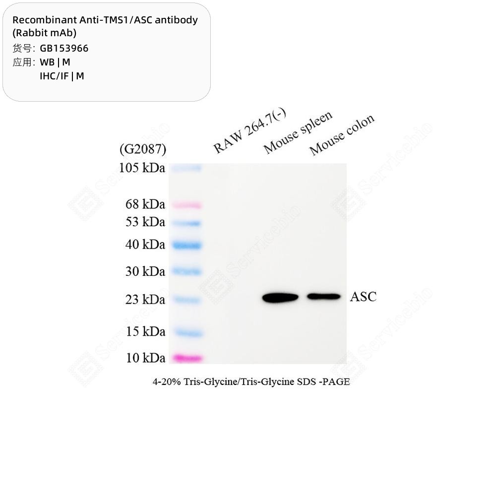 Recombinant Anti-TMS1/ASC antibody (Rabbit mAb)