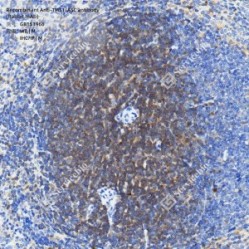 Recombinant Anti-TMS1/ASC antibody (Rabbit mAb)