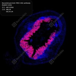 Recombinant Anti-TMS1/ASC antibody (Rabbit mAb)