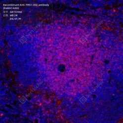 Recombinant Anti-TMS1/ASC antibody (Rabbit mAb)