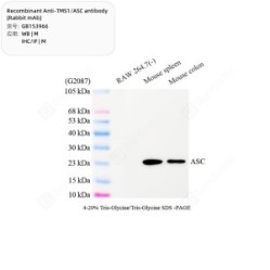Recombinant Anti-TMS1/ASC antibody (Rabbit mAb)
