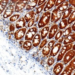 Recombinant Anti-TMS1/ASC antibody (Rabbit mAb)