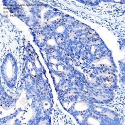 Recombinant Anti-Survivin antibody (Rabbit mAb)