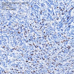 Recombinant Anti-Survivin antibody (Rabbit mAb)