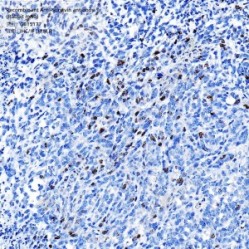 Recombinant Anti-Survivin antibody (Rabbit mAb)