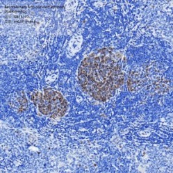 Recombinant Anti-Survivin antibody (Rabbit mAb)