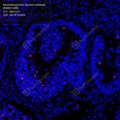 Recombinant Anti-Survivin antibody (Rabbit mAb)