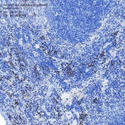 Recombinant Anti-Survivin antibody (Rabbit mAb)