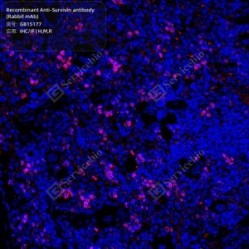 Recombinant Anti-Survivin antibody (Rabbit mAb)