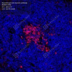 Recombinant Anti-Survivin antibody (Rabbit mAb)