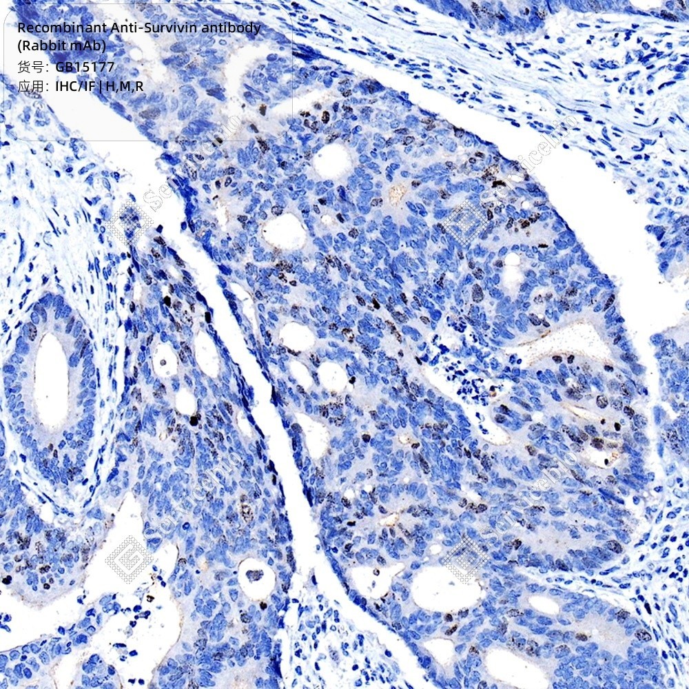 Recombinant Anti-Survivin antibody (Rabbit mAb)