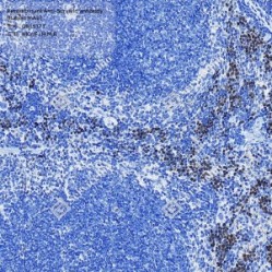 Recombinant Anti-Survivin antibody (Rabbit mAb)