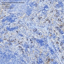 Recombinant Anti-Survivin antibody (Rabbit mAb)