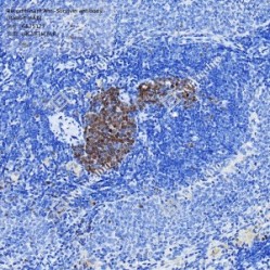 Recombinant Anti-Survivin antibody (Rabbit mAb)