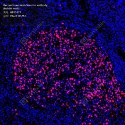 Recombinant Anti-Survivin antibody (Rabbit mAb)