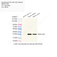 Recombinant Anti-TMS1/ASC...