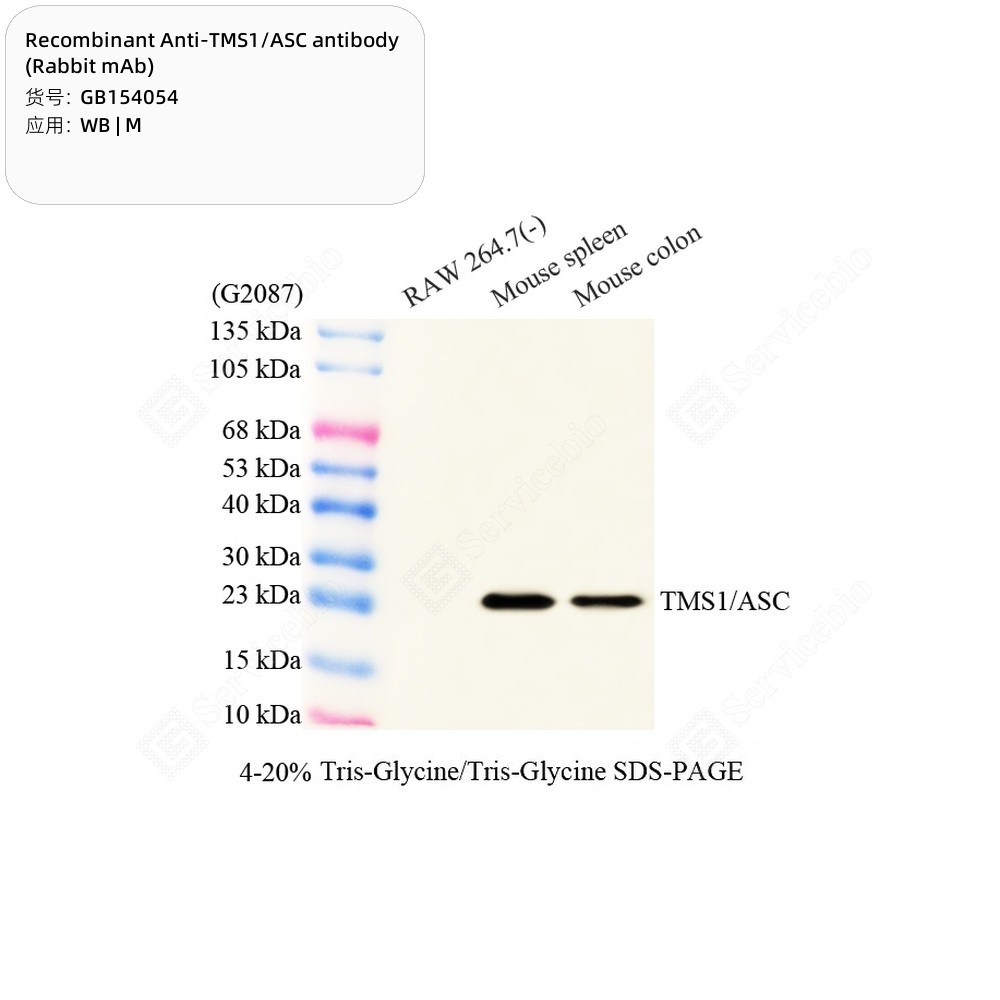 Recombinant Anti-TMS1/ASC antibody (Rabbit mAb)