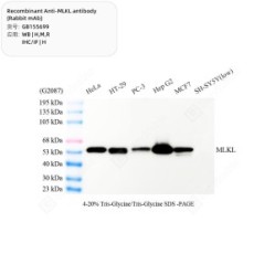 Recombinant Anti-MLKL antibody (Rabbit mAb)