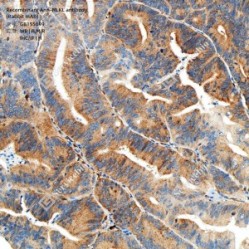 Recombinant Anti-MLKL antibody (Rabbit mAb)
