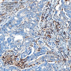 Recombinant Anti-MLKL antibody (Rabbit mAb)