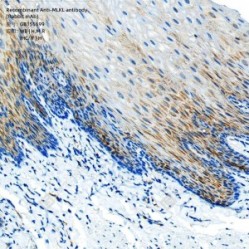 Recombinant Anti-MLKL antibody (Rabbit mAb)