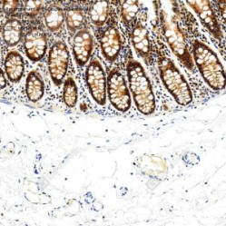 Recombinant Anti-Caspase-3 antibody (Rabbit mAb)
