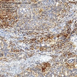 Recombinant Anti-Caspase-3 antibody (Rabbit mAb)