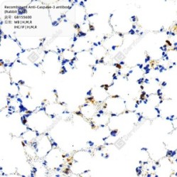 Recombinant Anti-Caspase-3 antibody (Rabbit mAb)