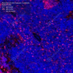 Recombinant Anti-Caspase-3 antibody (Rabbit mAb)