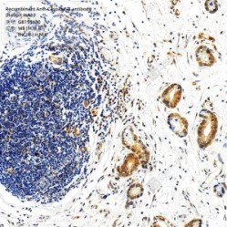Recombinant Anti-Caspase-3 antibody (Rabbit mAb)