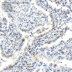 Recombinant Anti-Caspase-3 antibody (Rabbit mAb)