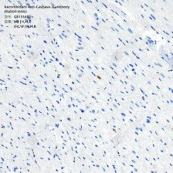 Recombinant Anti-Caspase-3 antibody (Rabbit mAb)