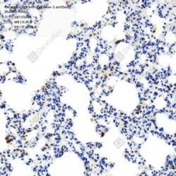 Recombinant Anti-Caspase-3 antibody (Rabbit mAb)