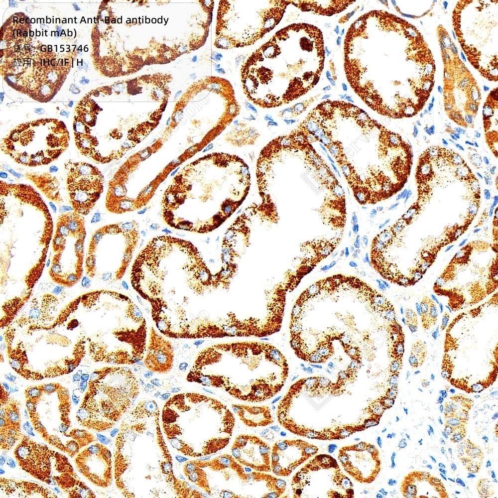 Recombinant Anti-Bad antibody (Rabbit mAb)