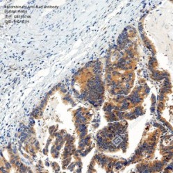 Recombinant Anti-Bad antibody (Rabbit mAb)