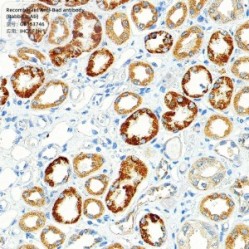 Recombinant Anti-Bad antibody (Rabbit mAb)