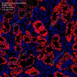 Recombinant Anti-Bad antibody (Rabbit mAb)