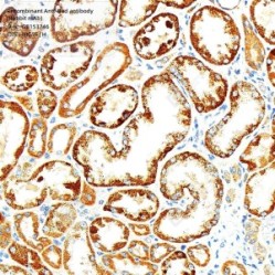 Recombinant Anti-Bad antibody (Rabbit mAb)
