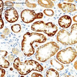 Recombinant Anti-Bad antibody (Rabbit mAb)