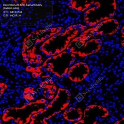 Recombinant Anti-Bad antibody (Rabbit mAb)