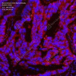 Recombinant Anti-Bad antibody (Rabbit mAb)