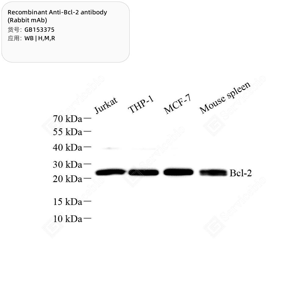 Recombinant Anti-Bcl-2 antibody (Rabbit mAb)